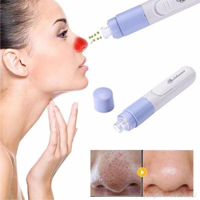 Вакуумний очищувач SPOTCLEANER Face Pore Cleaner вакуумний очищувач пор обличчя RP-38